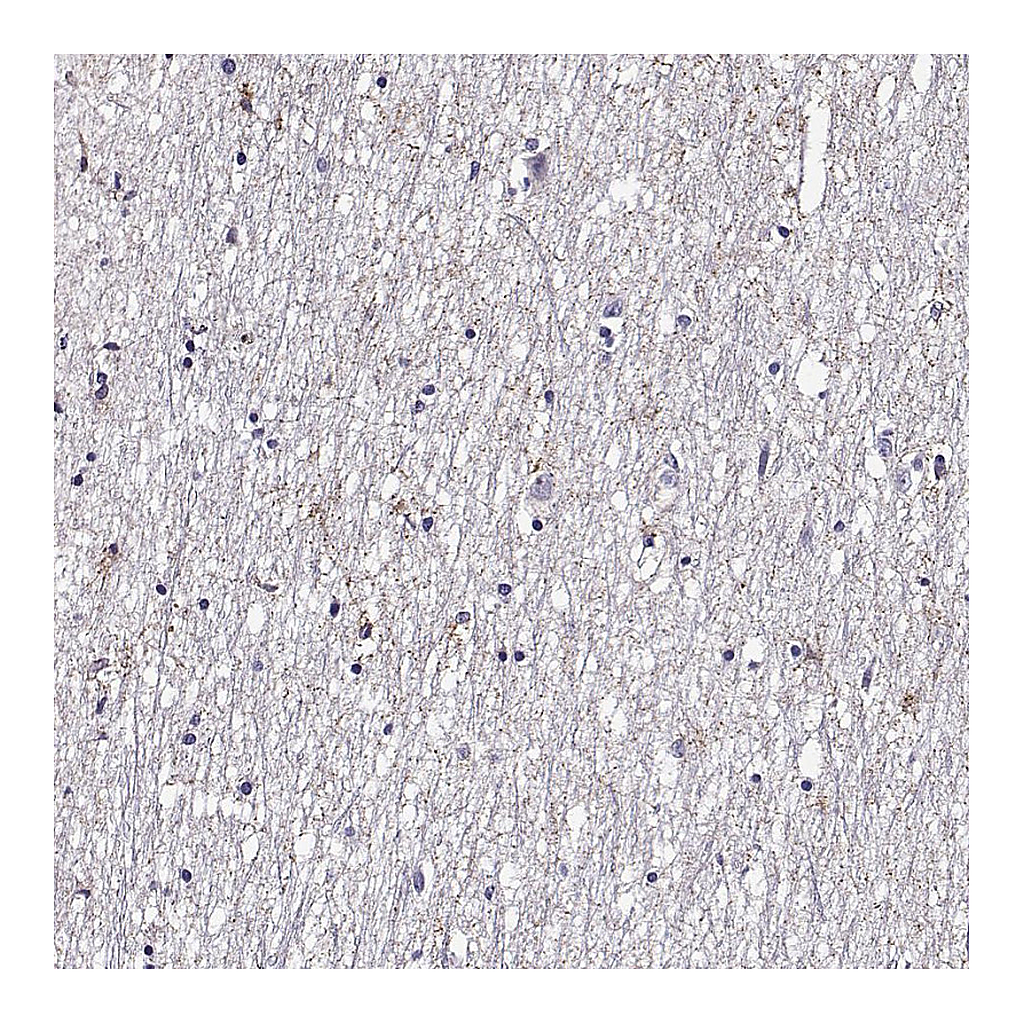 Atlas Antibodies Anti-FEZF1 Antibody