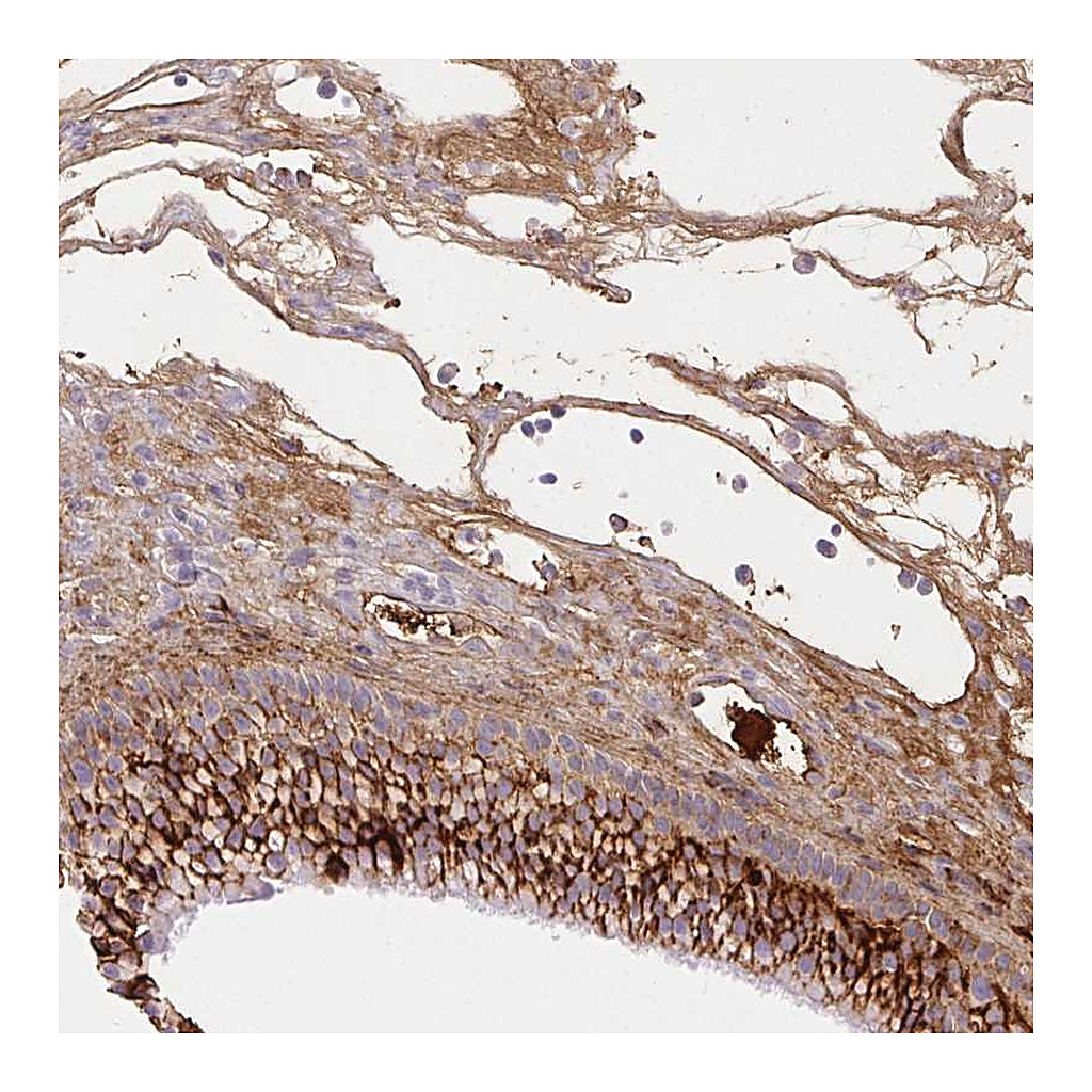 Atlas Antibodies Anti-FGA Antibody