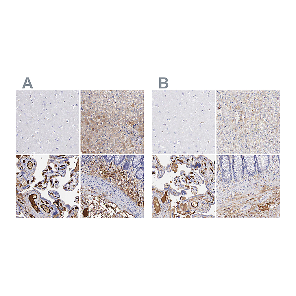 Atlas Antibodies Anti-FGB Antibody