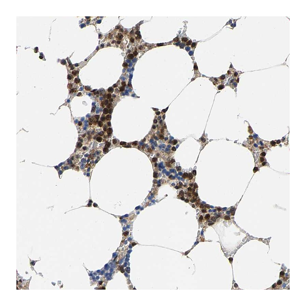 Atlas Antibodies Anti-FGD3 Antibody