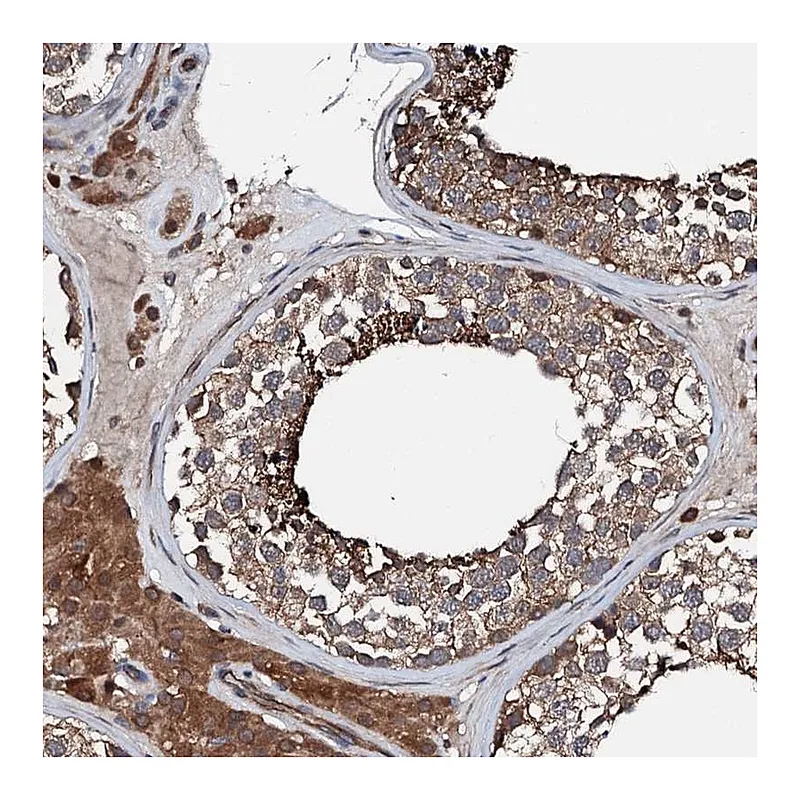 Atlas Antibodies Anti-FGD4 Antibody