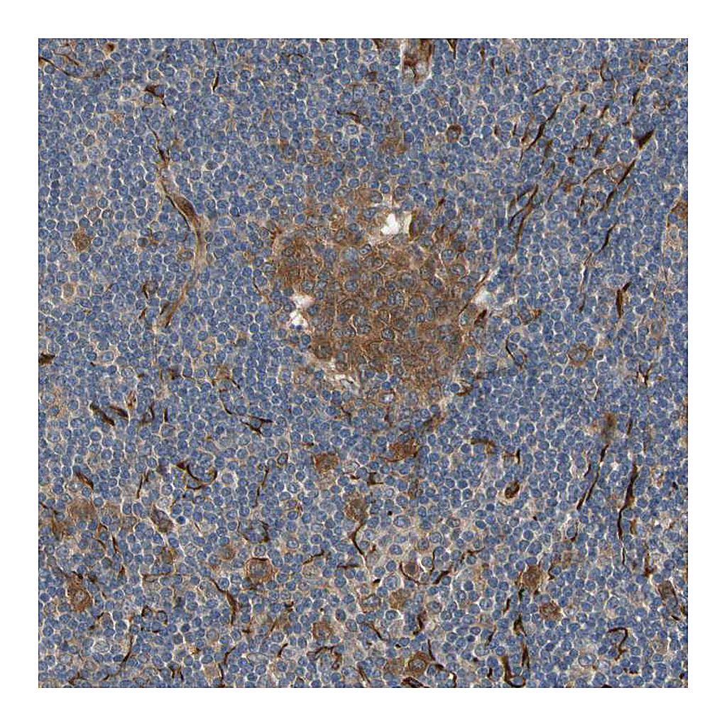 Atlas Antibodies Anti-FGD6 Antibody