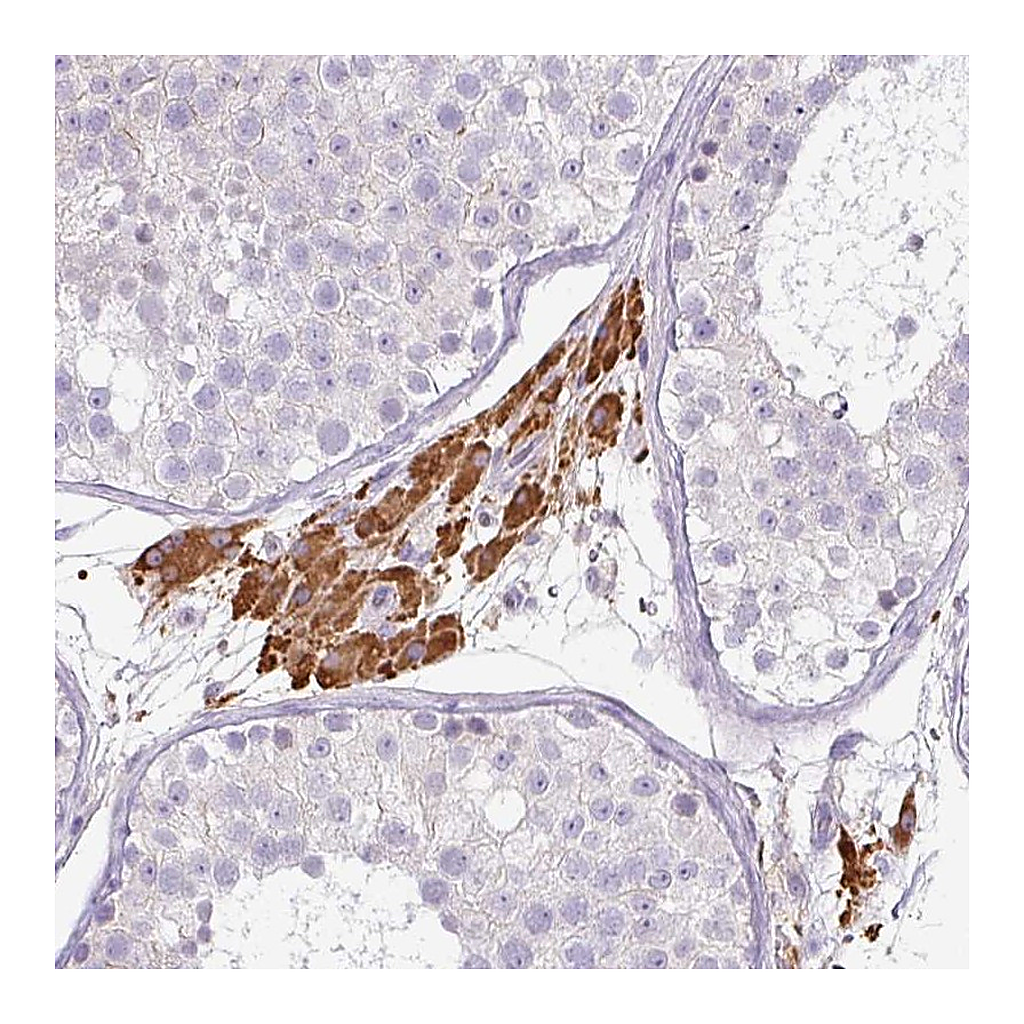 Atlas Antibodies Anti-FGF17 Antibody