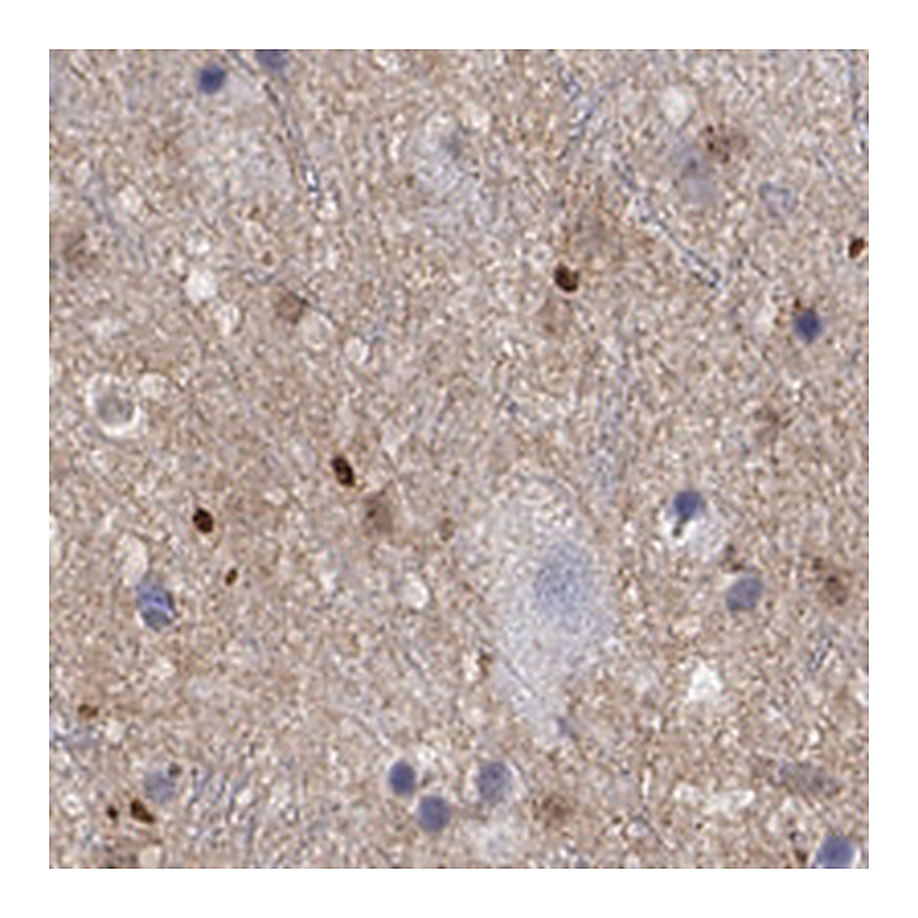 Atlas Antibodies Anti-FGF2 Antibody