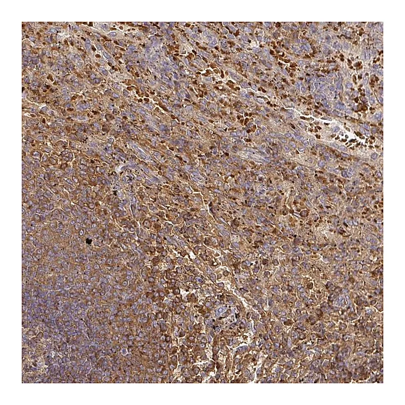 Atlas Antibodies Anti-FGF21 Antibody