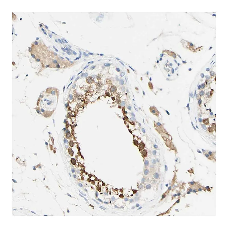 Atlas Antibodies Anti-FGF4 Antibody