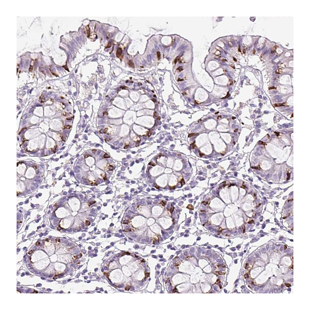 Atlas Antibodies Anti-FGFBP3 Antibody