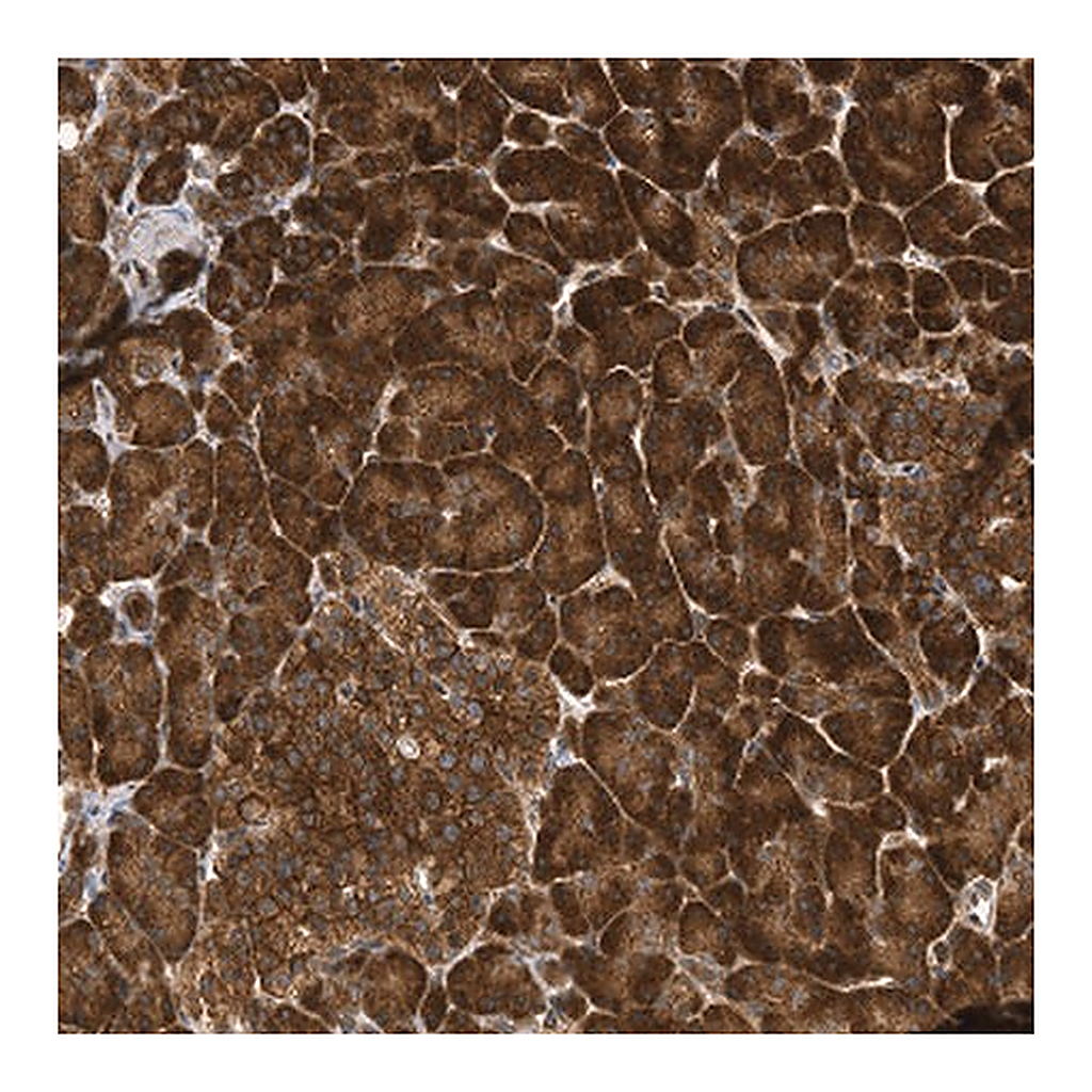 Atlas Antibodies Anti-FGFR1 Antibody