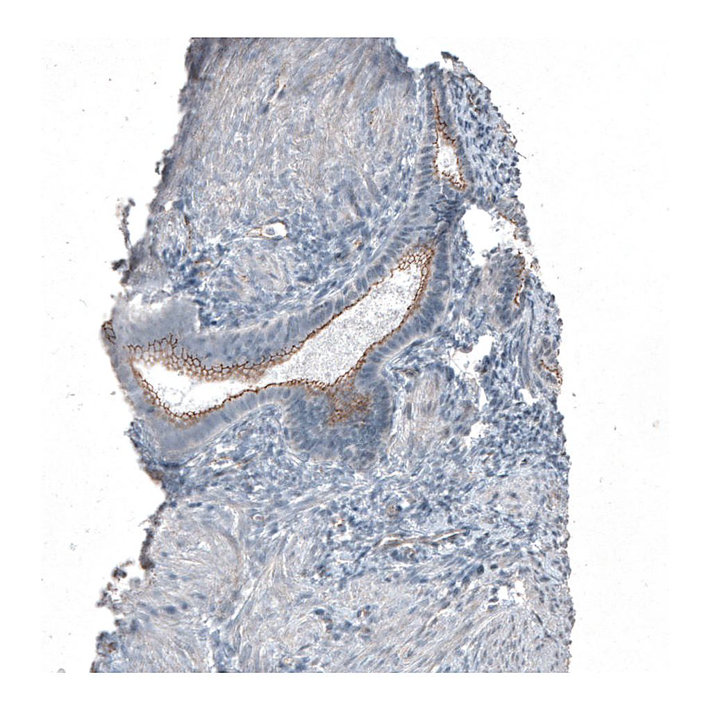 Atlas Antibodies Anti-FGFR2 Antibody
