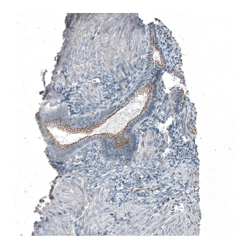 Atlas Antibodies Anti-FGFR2 Antibody