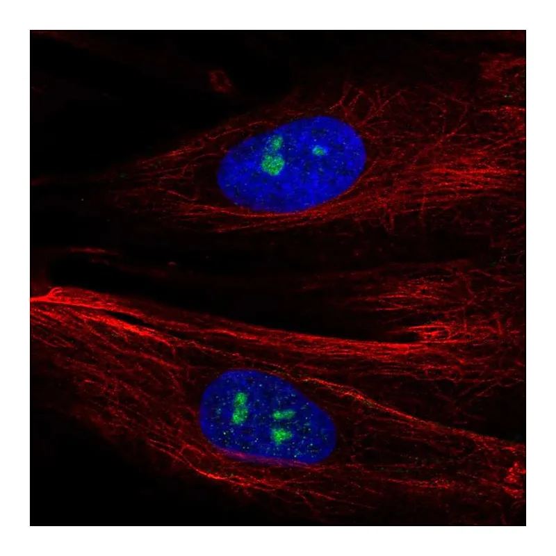 Atlas Antibodies Anti-FGFR1 Antibody