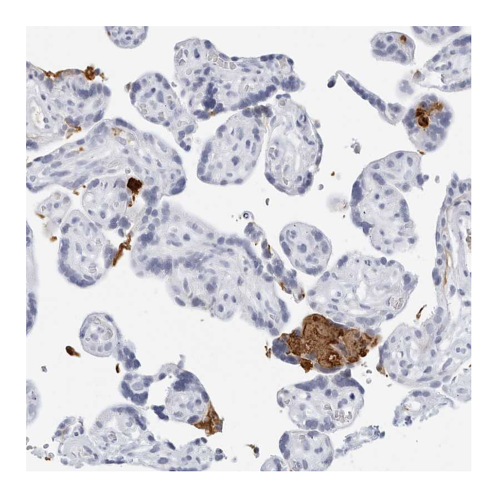 Atlas Antibodies Anti-FGG Antibody