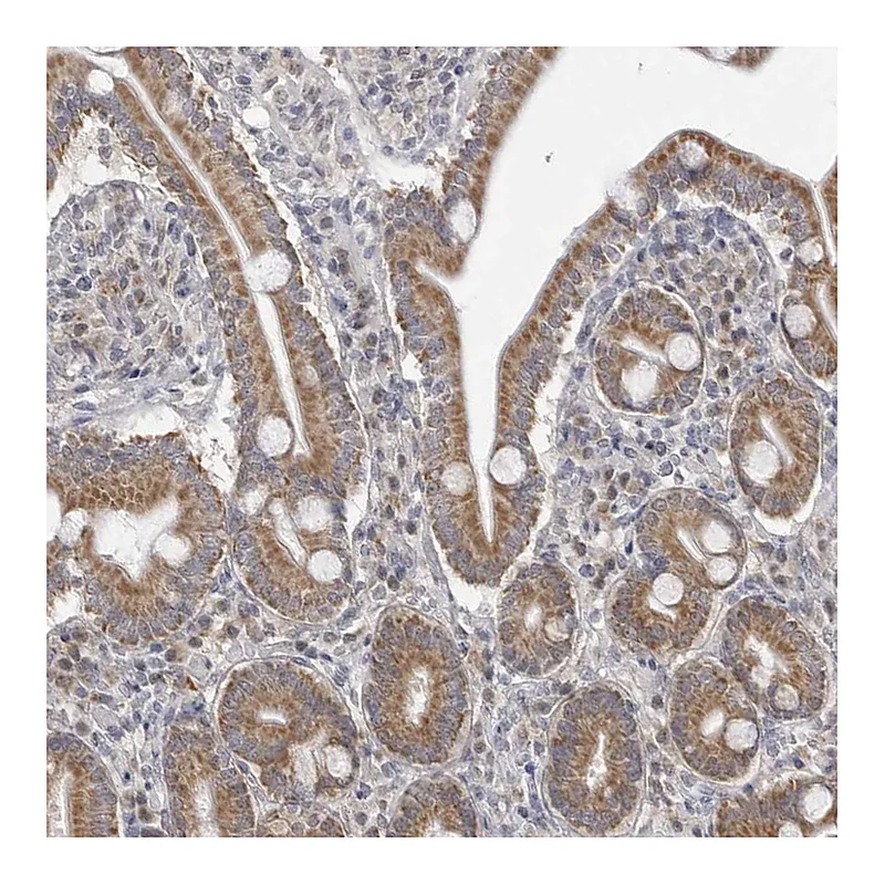 Atlas Antibodies Anti-FH Antibody