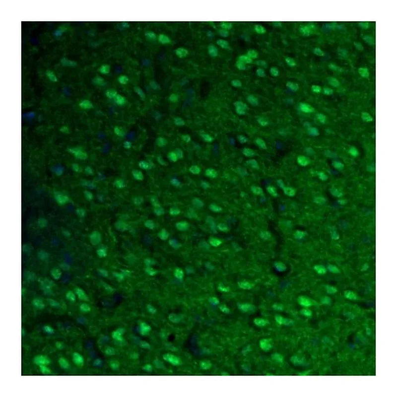 Atlas Antibodies Anti-FH Antibody