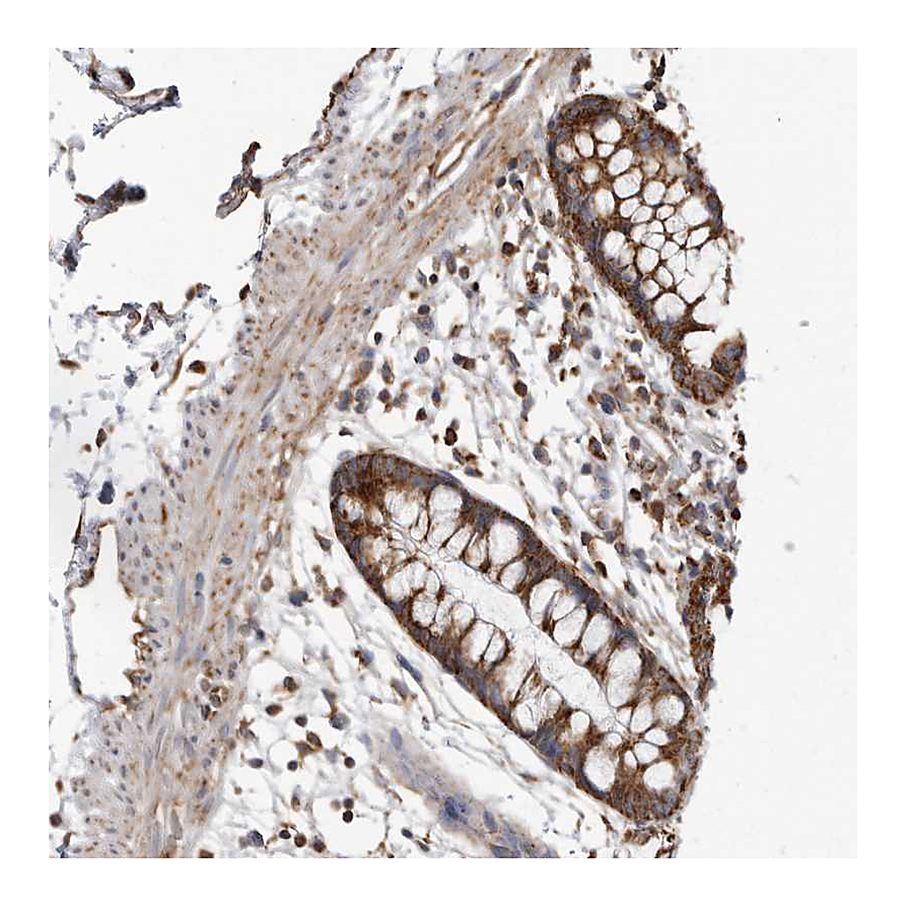 Atlas Antibodies Anti-FH Antibody