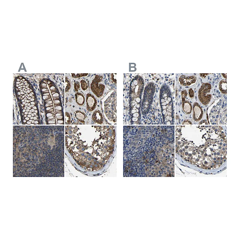 Atlas Antibodies Anti-FHIT Antibody