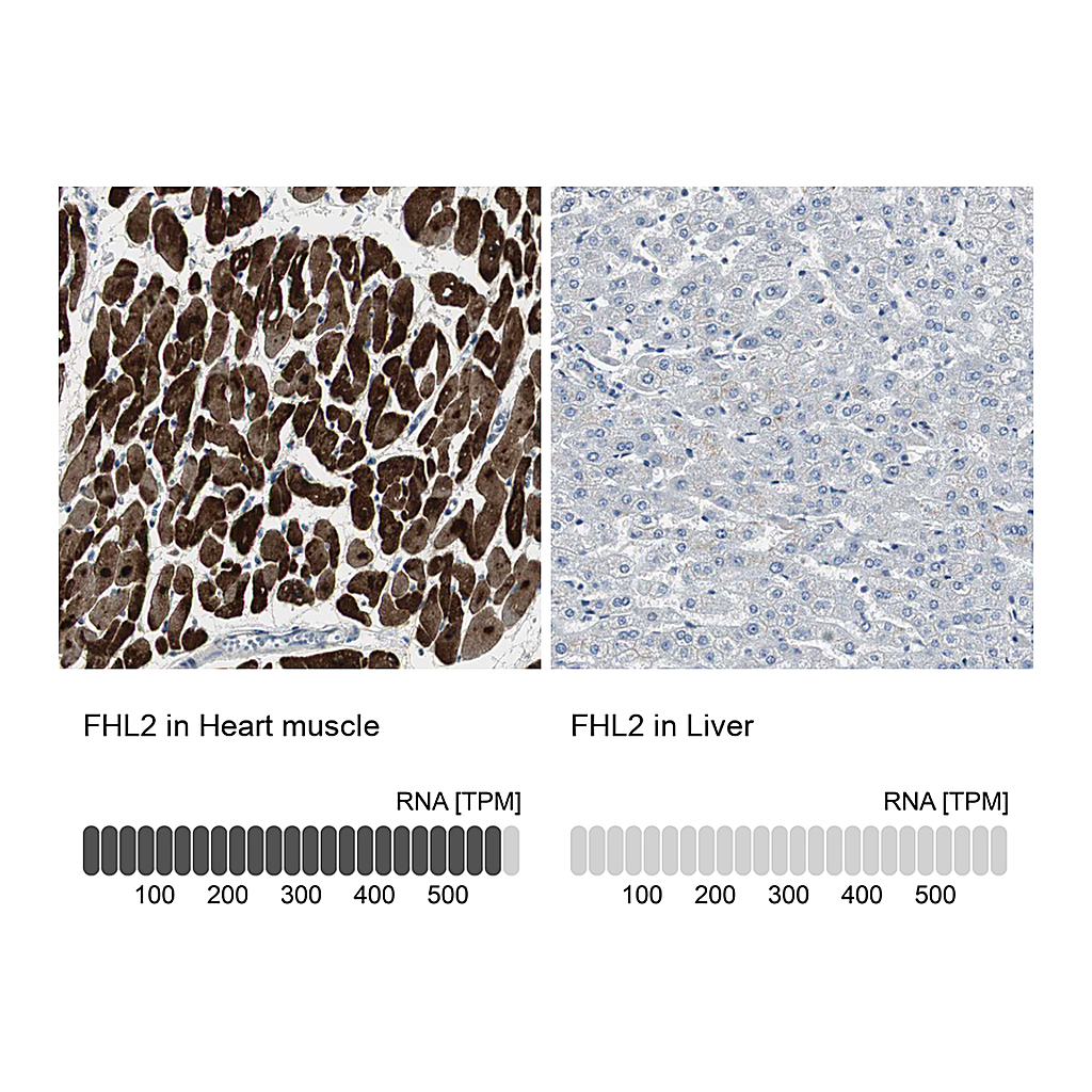 Atlas Antibodies Anti-FHL2 Antibody