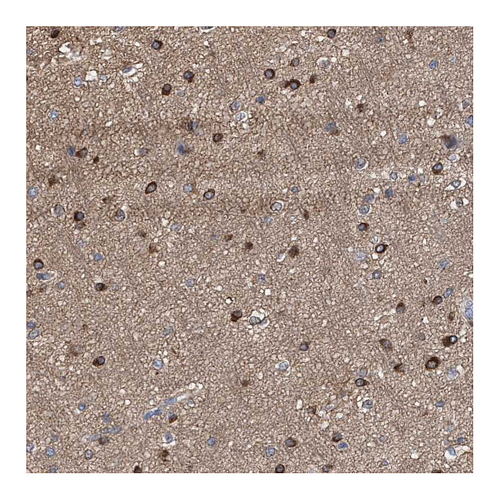 Atlas Antibodies Anti-FHOD3 Antibody