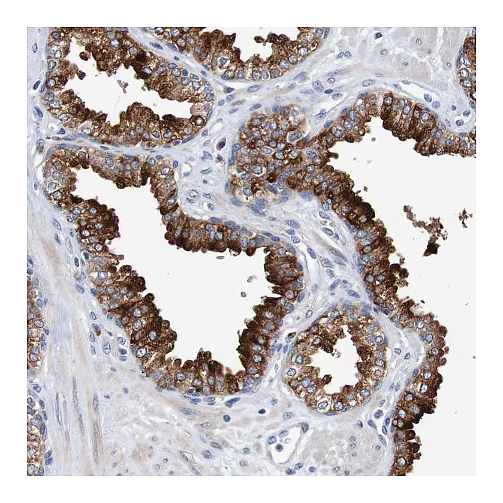 Atlas Antibodies Anti-FIBP Antibody