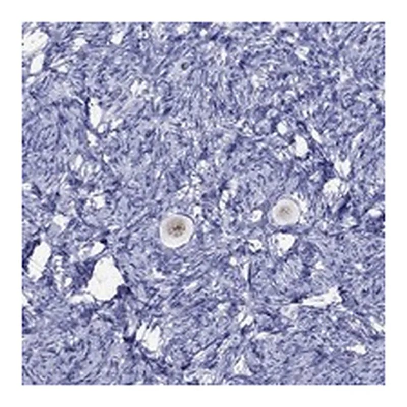 Atlas Antibodies Anti-FIGLA Antibody
