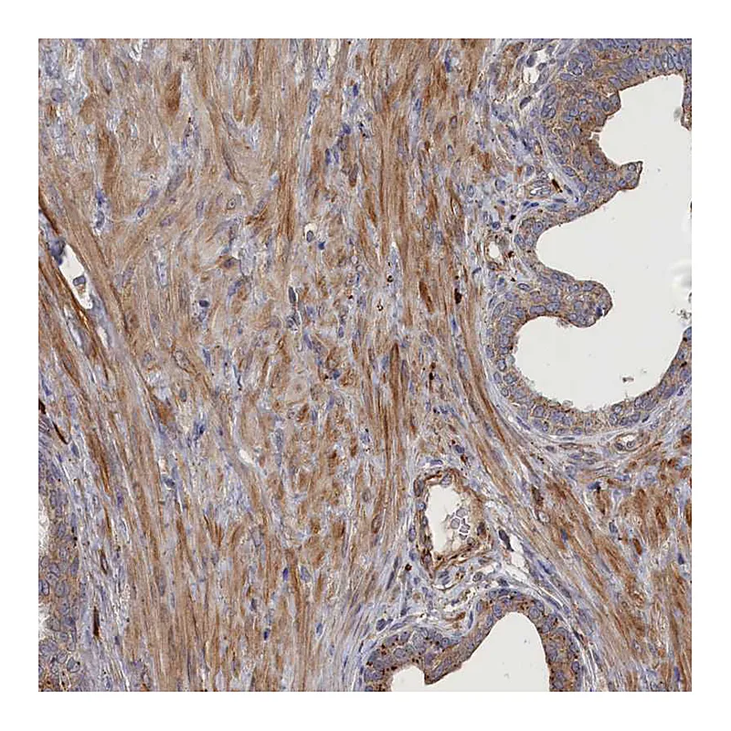 Atlas Antibodies Anti-FILIP1L Antibody