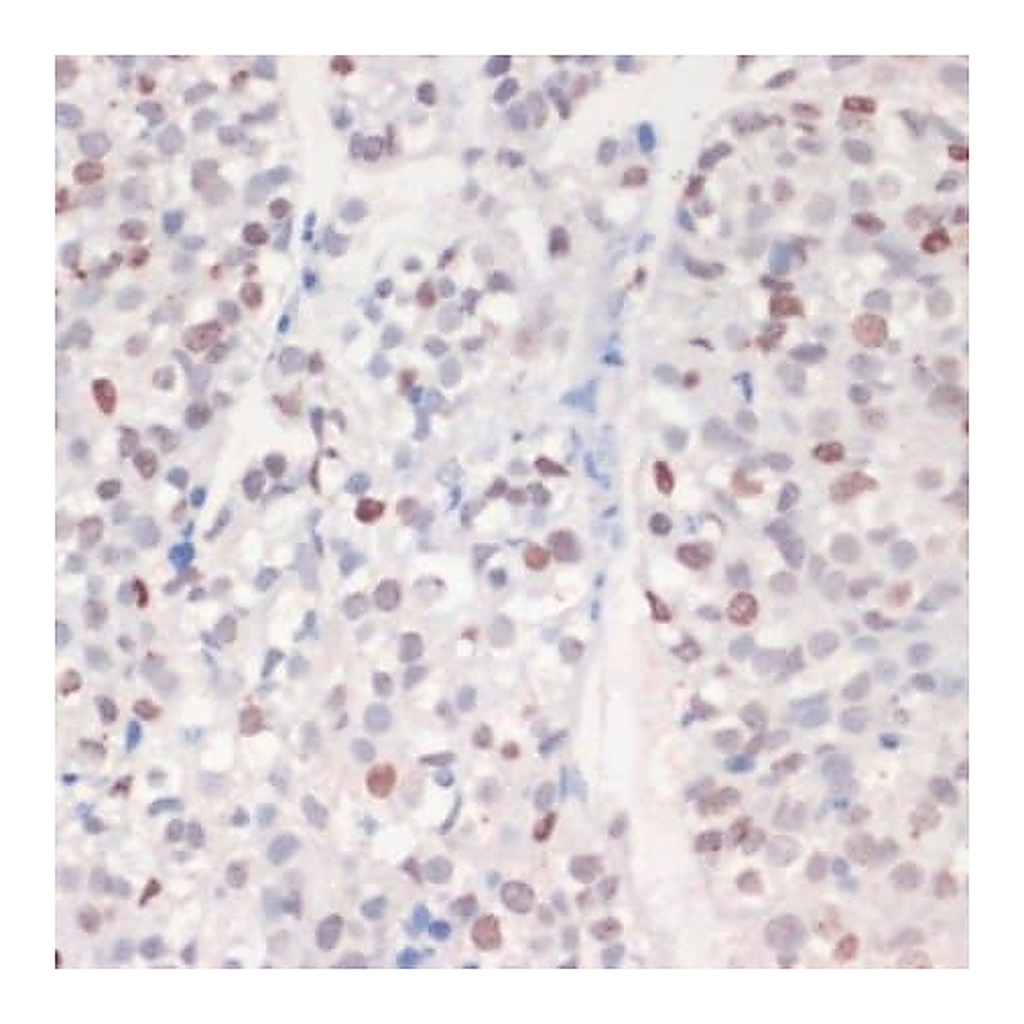 Merck Anti-Phospho-gammaH2A.X-S139 antibody produced in rabbit