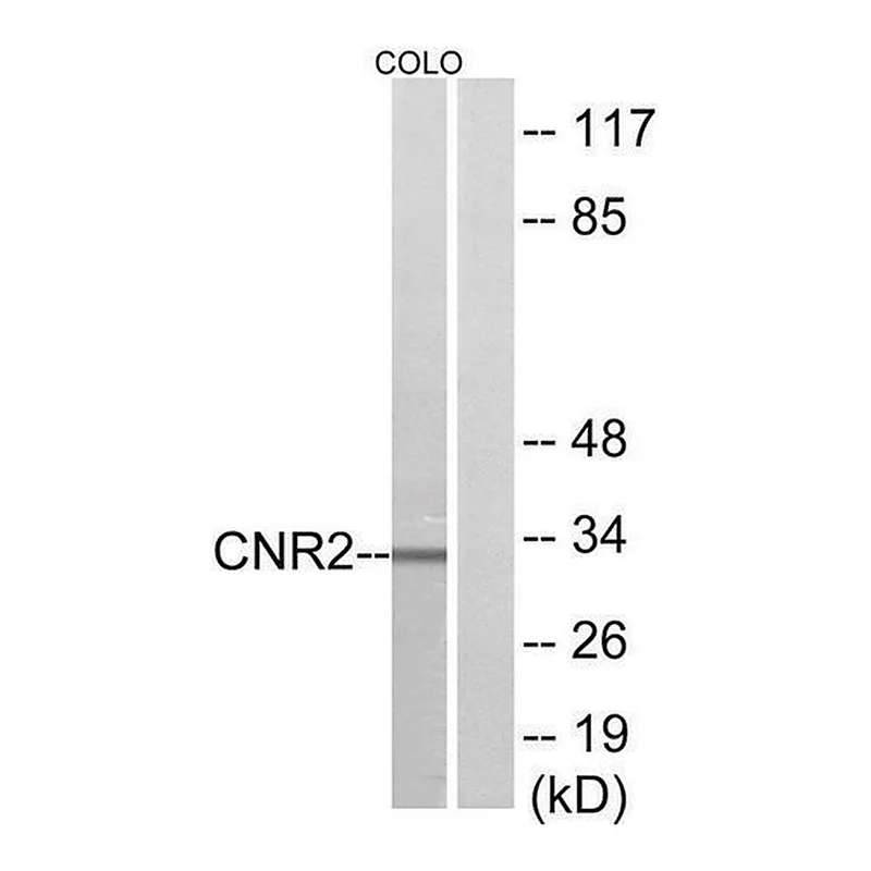 Merck Anti-CNR2 antibody produced in rabbit