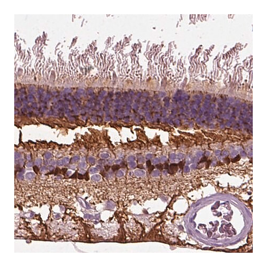Merck Anti-CRABP1 antibody produced in rabbit