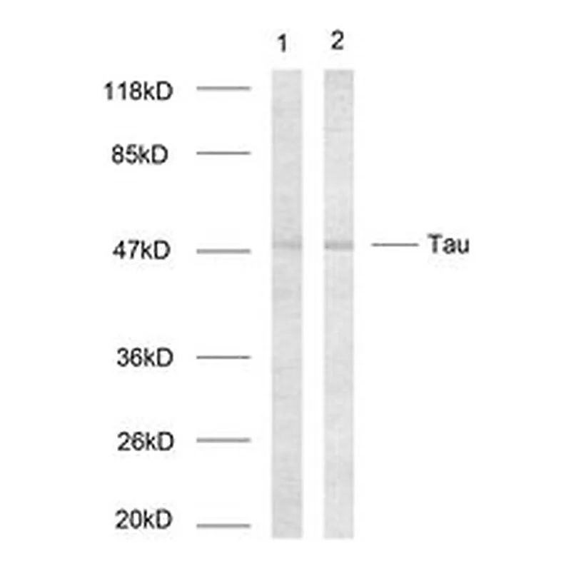 Merck ANTI-TAU