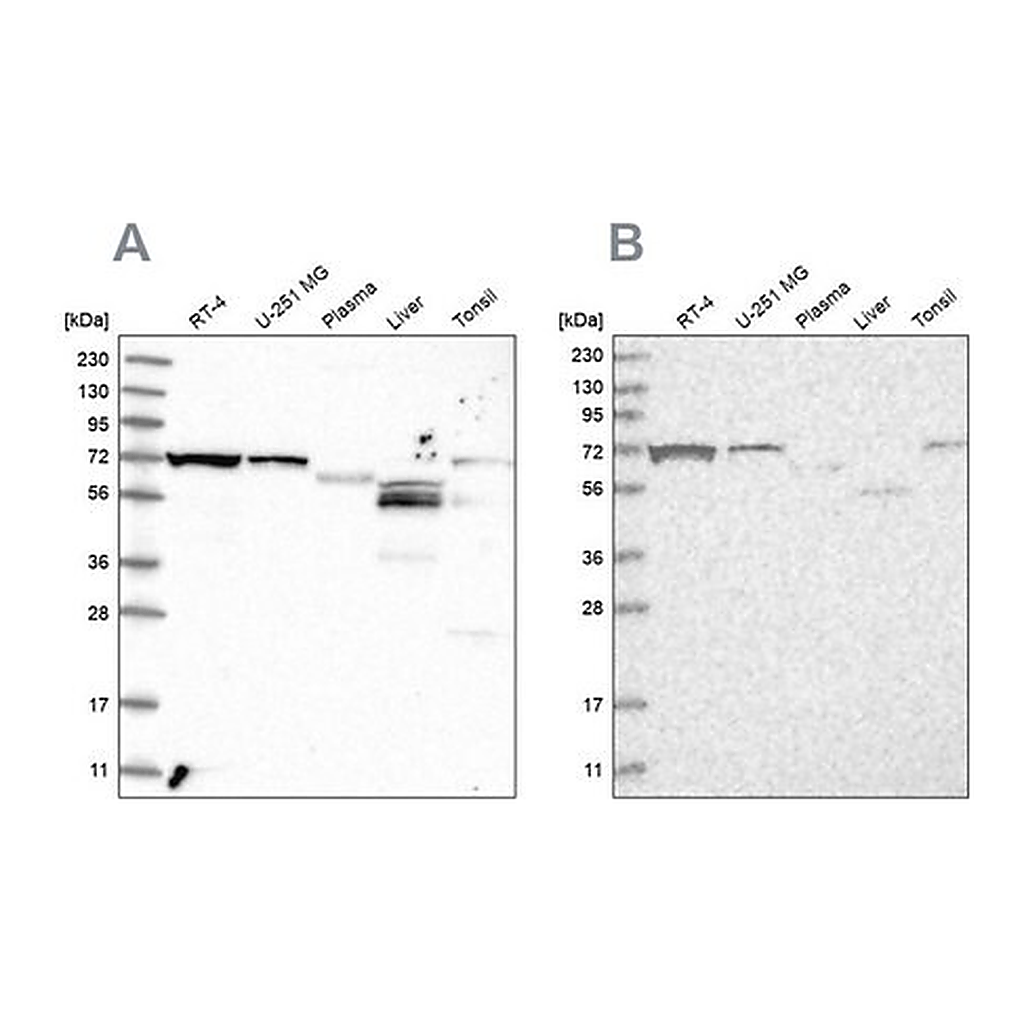 Merck Anti-SLC25A12 antibody produced in rabbit