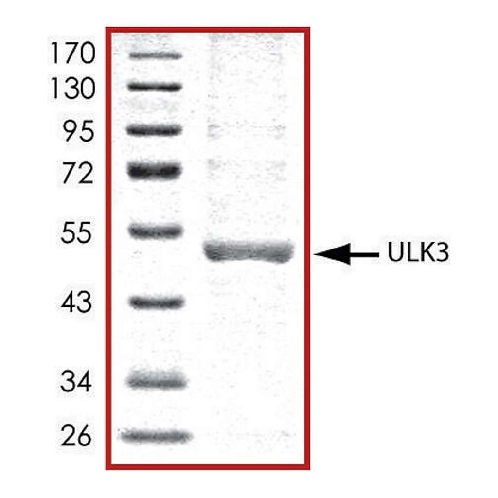 Merck ULK3, active, His tagged human