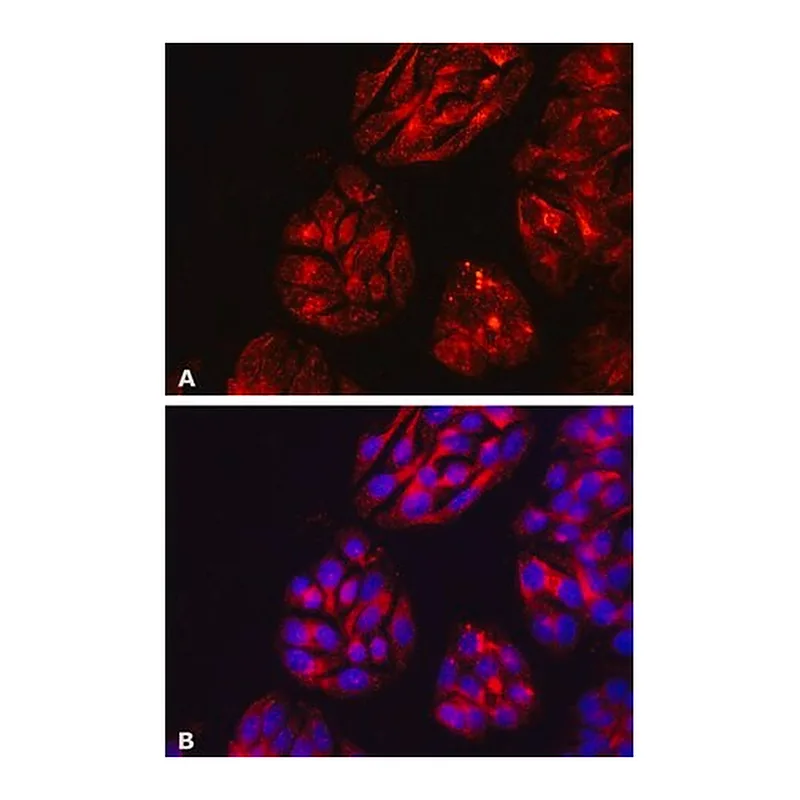 Merck Anti-DPP4/CD26 antibody, Mouse monoclonal