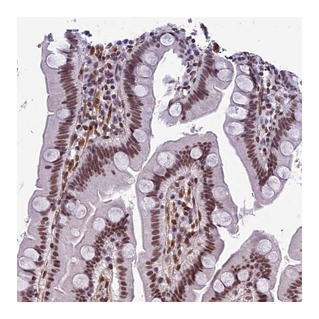 Merck Anti-NIPBL antibody produced in rabbit