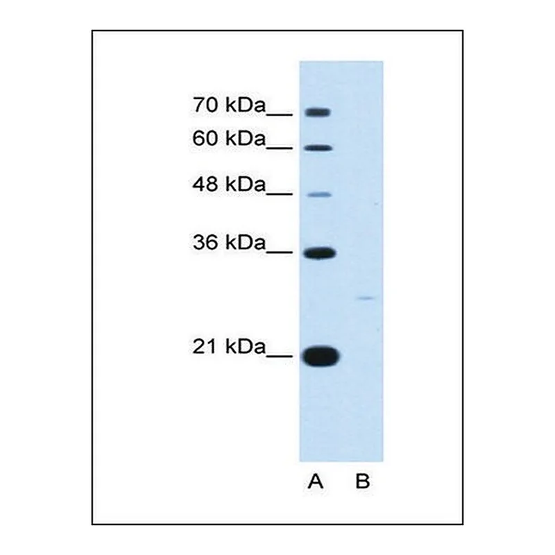 Merck Anti-YWHAZ antibody produced in rabbit
