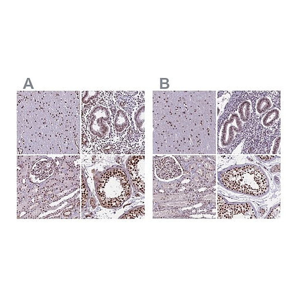 Merck Anti-MPHOSPH8 antibody produced in rabbit