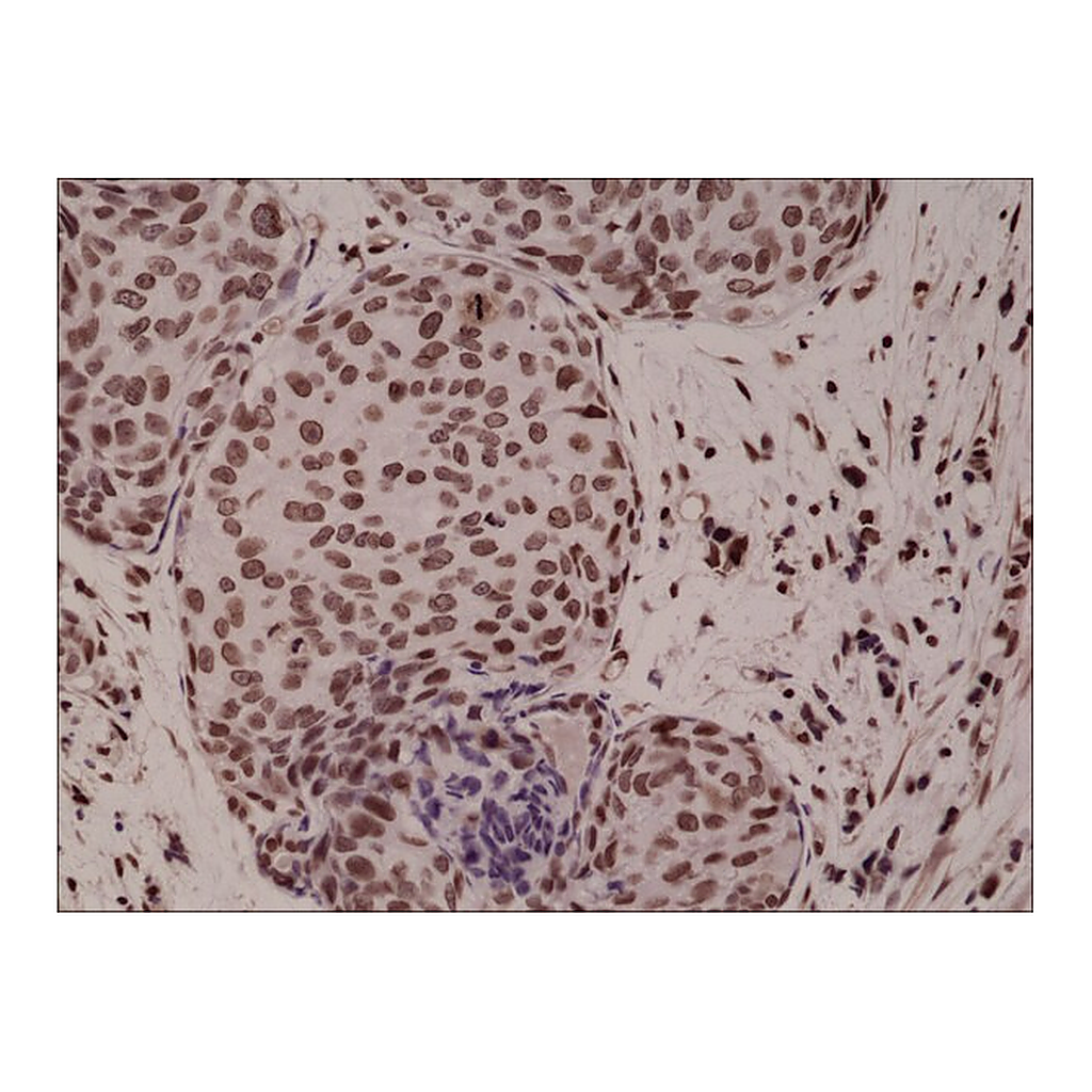 Merck Anti-p38 MAPK Phospho (pT180/pY182) antibody, Rabbit monoclonal