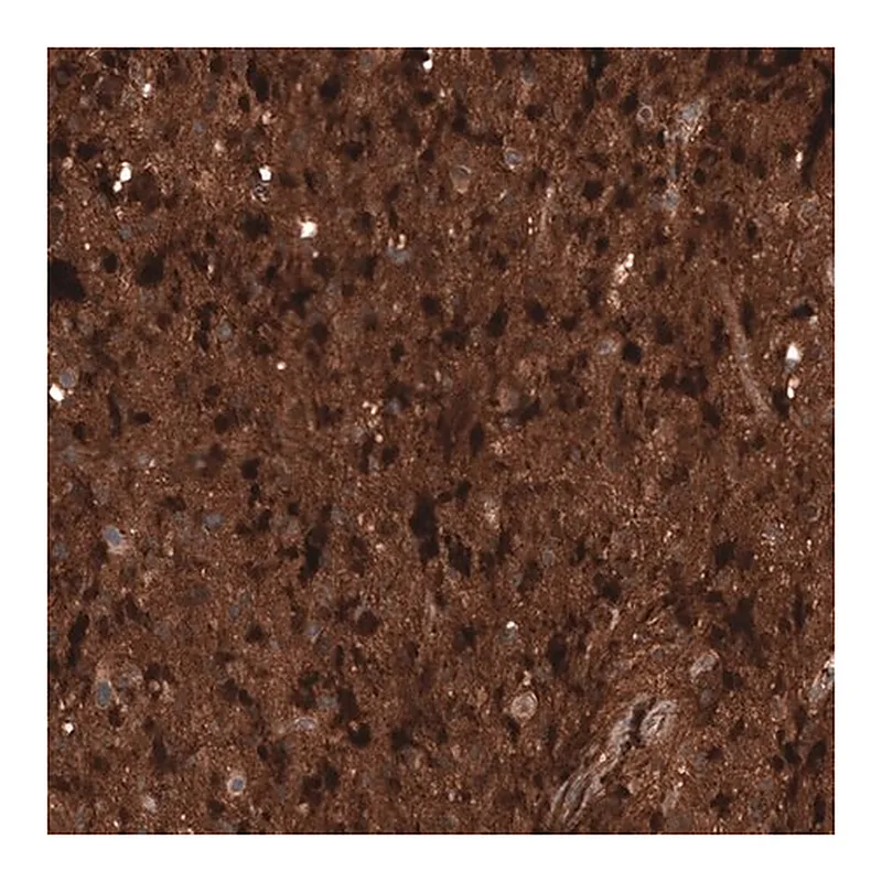 Merck Monoclonal Anti-CHI3L1 antibody produced in mouse