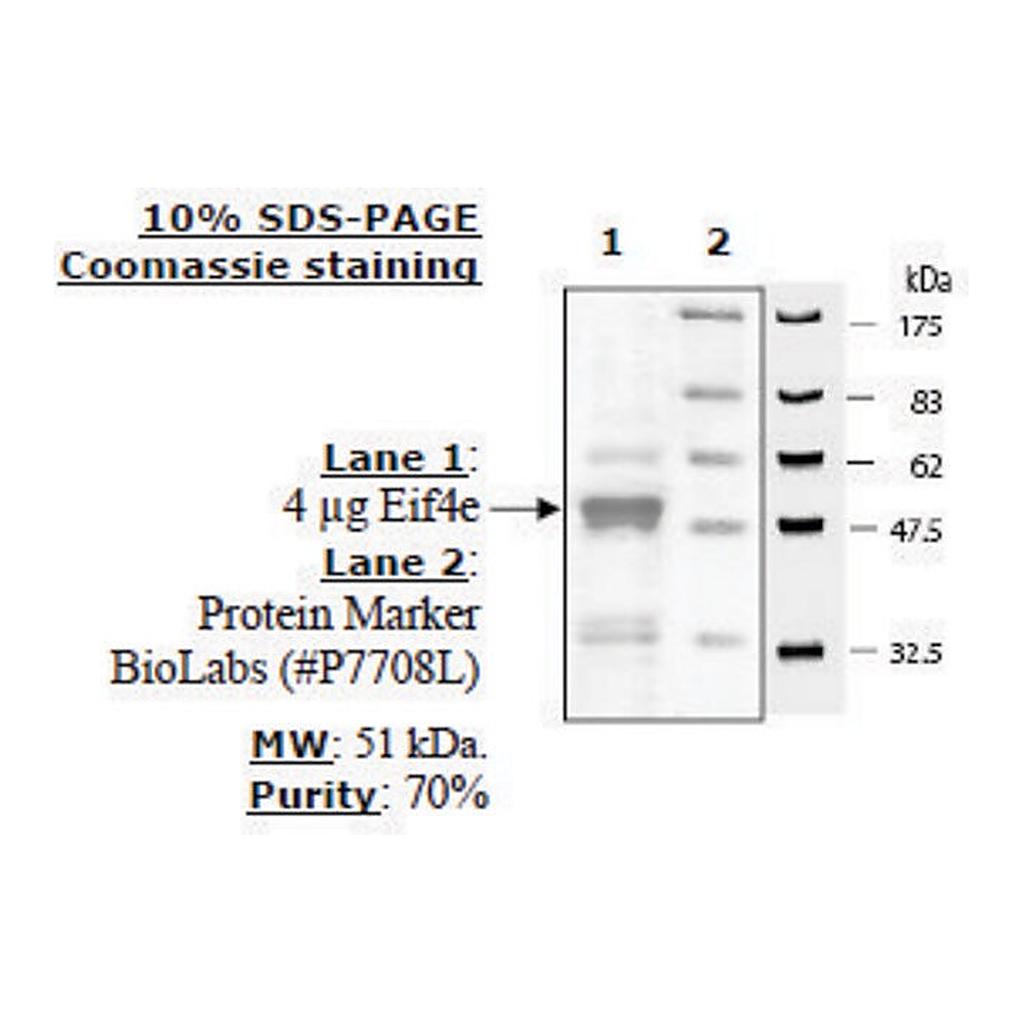 Merck eIF4E Active human