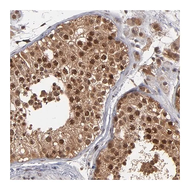 Merck Anti-HUWE1 antibody produced in rabbit