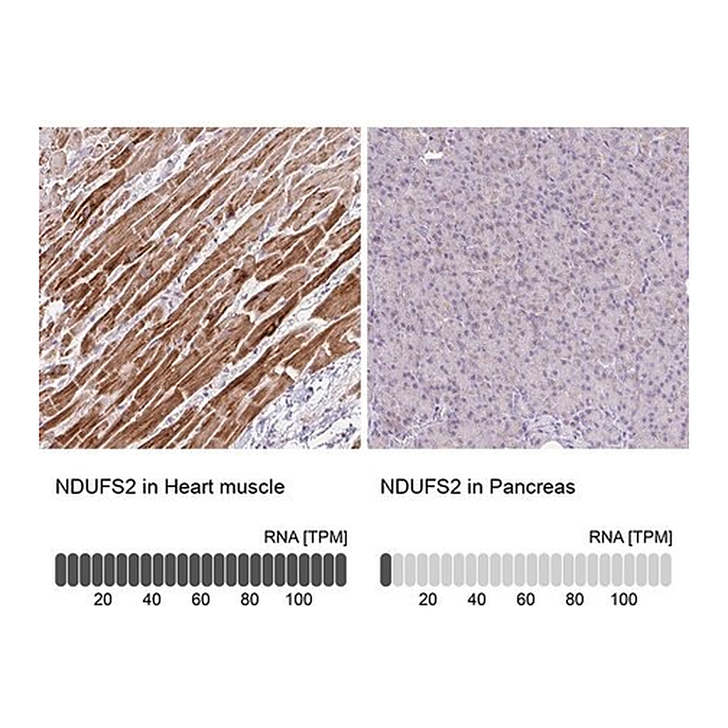 Merck Anti-NDUFS2 antibody produced in rabbit