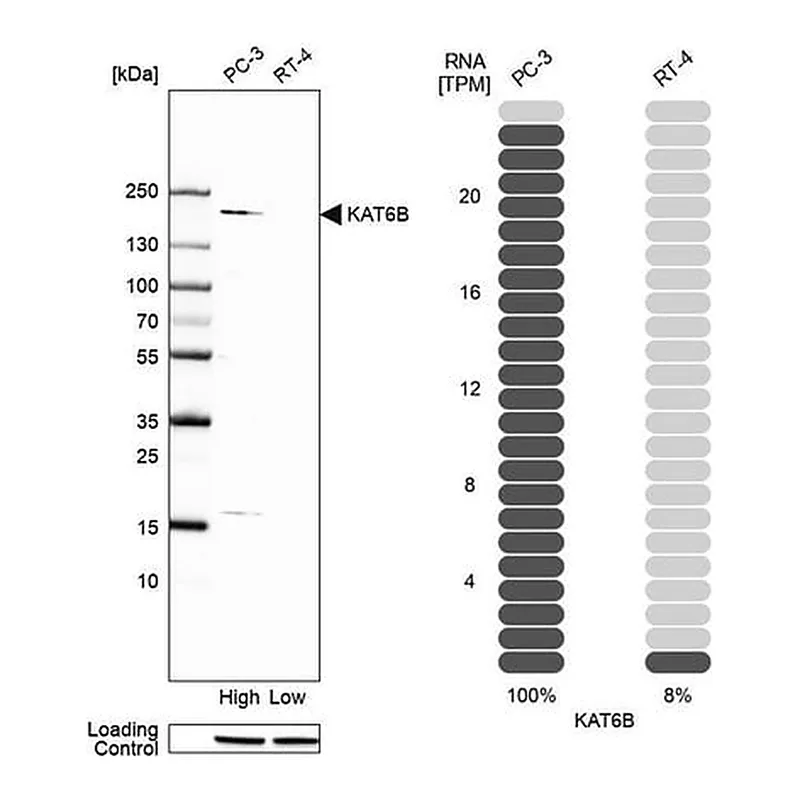 Merck Anti-KAT6B antibody produced in rabbit