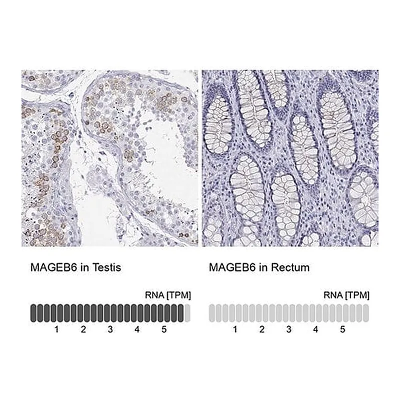 Merck Anti-MAGEB6 antibody produced in rabbit