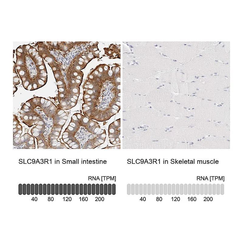 Atlas Antibodies Anti-SLC9A3R1 Antibody