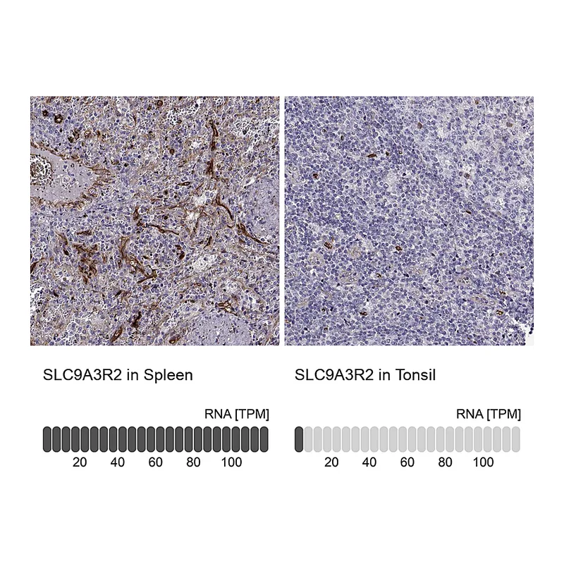 Atlas Antibodies Anti-SLC9A3R2 Antibody