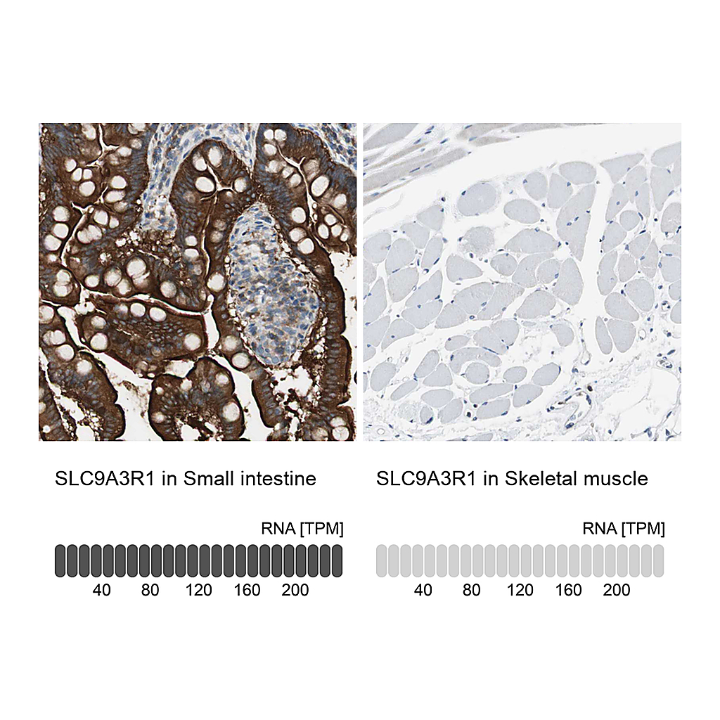 Atlas Antibodies Anti-SLC9A3R1 Antibody