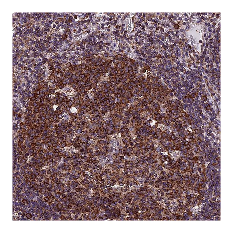 Atlas Antibodies Anti-SLC9A5 Antibody