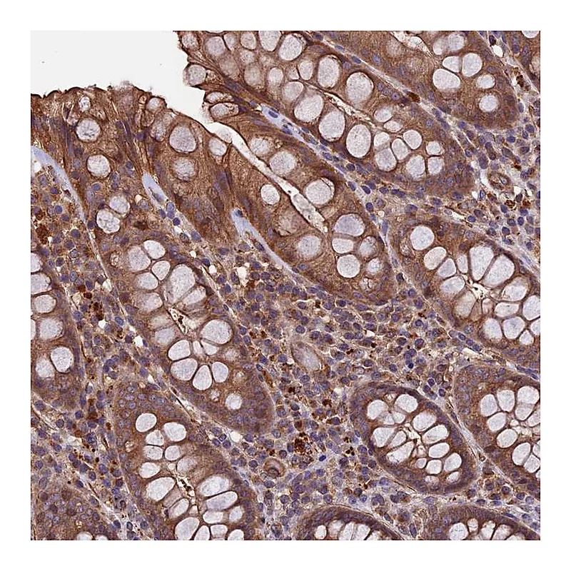Atlas Antibodies Anti-SLC9A5 Antibody