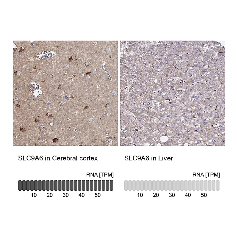 Atlas Antibodies Anti-SLC9A6 Antibody