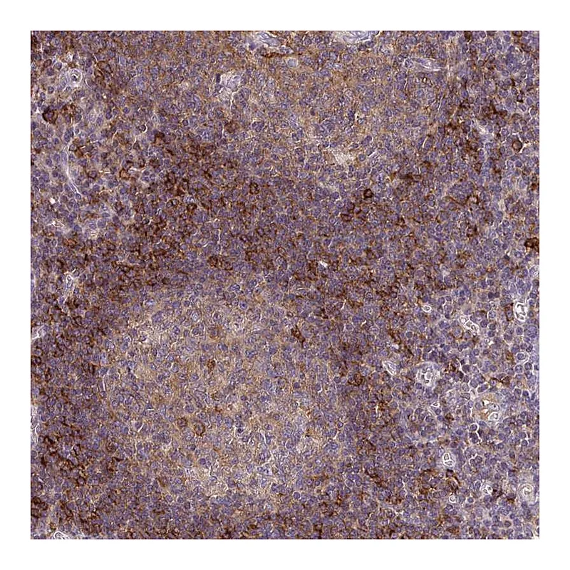 Atlas Antibodies Anti-SLC9A9 Antibody