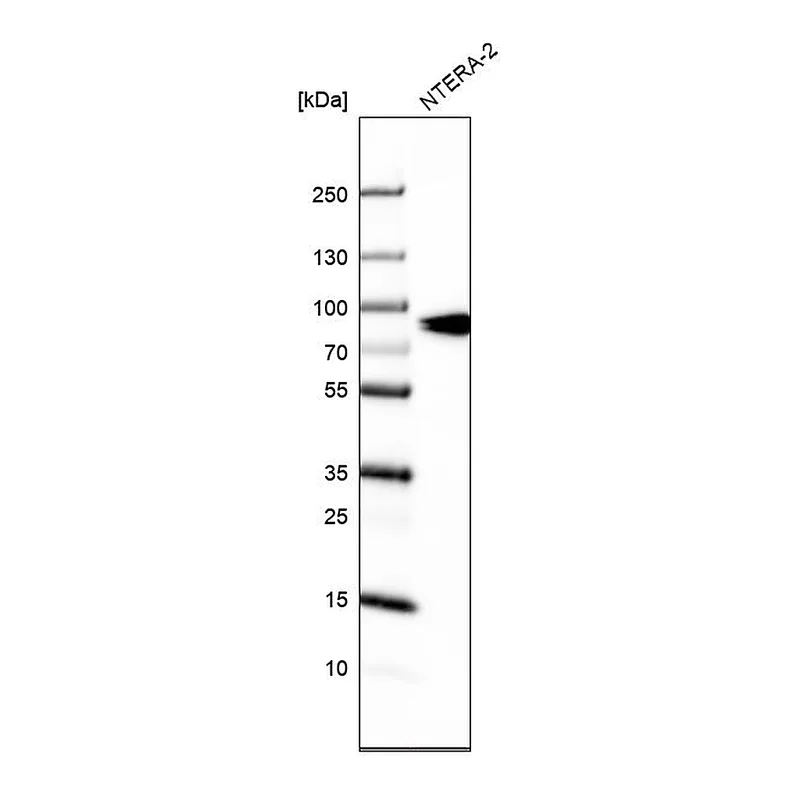 Atlas Antibodies Anti-SLCO1A2 Antibody